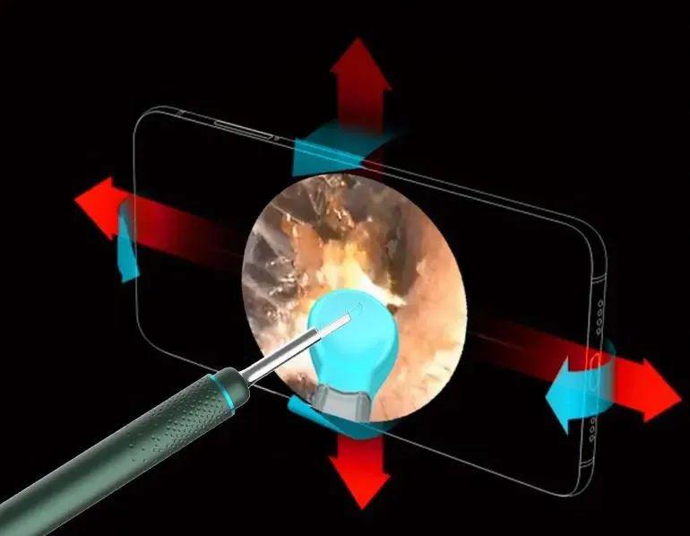 最新自動掏耳神器,最新自動掏耳神器，科技改變清潔耳朵的方式