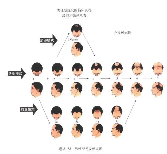 笨鳥先飛 第3頁(yè)